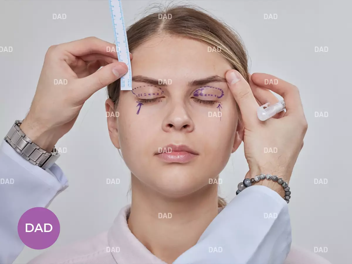 بهترین جراح بلفاروپلاستی