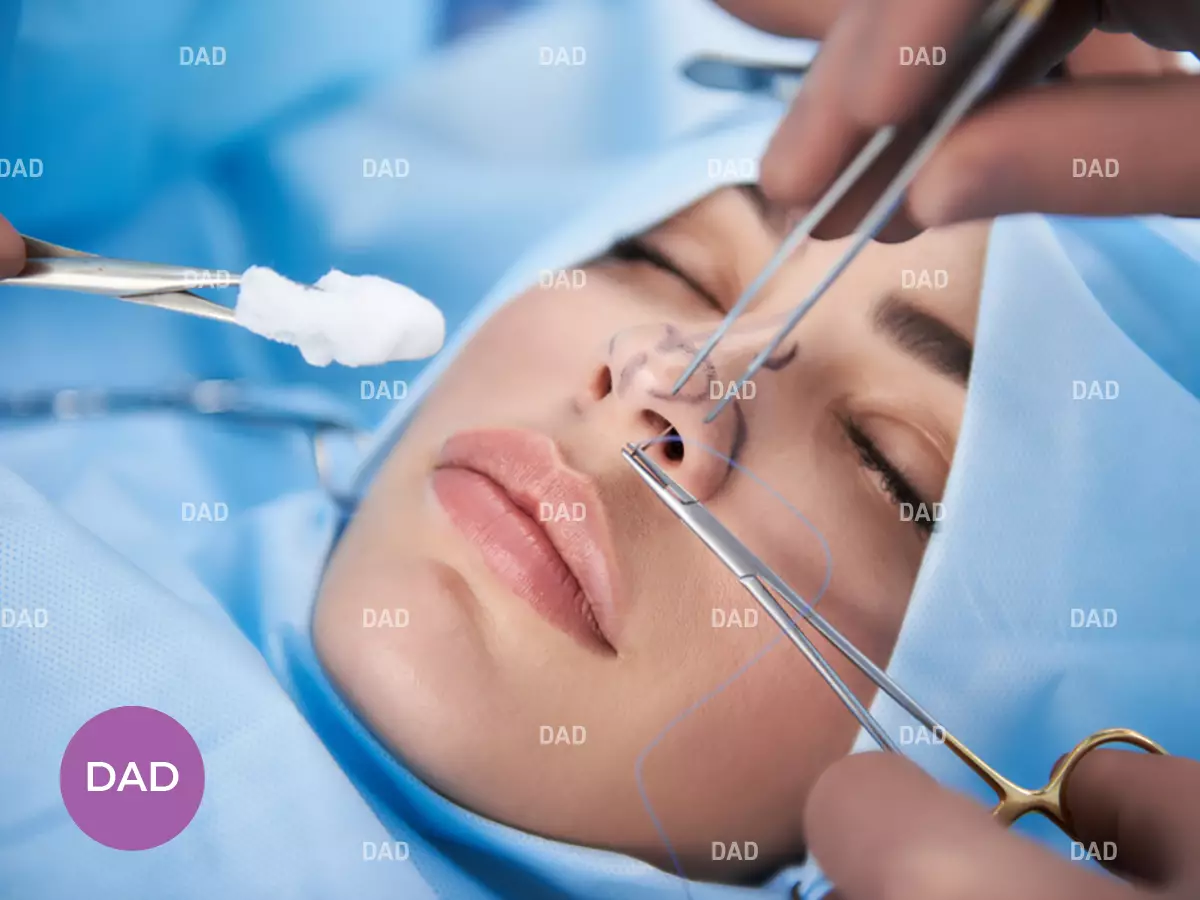 رینوپلاستی طبیعی یا فانتزی