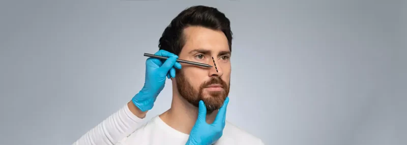 رینوپلاستی طبیعی یا فانتزی